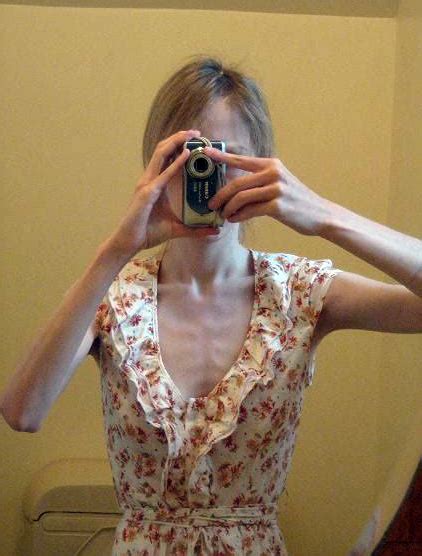 anorexic porn|anorexic videos .